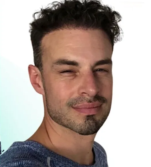 بعد زراعة الشعر، من الأمام
