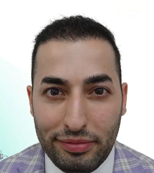 بعد زراعة الشعر، من الأمام